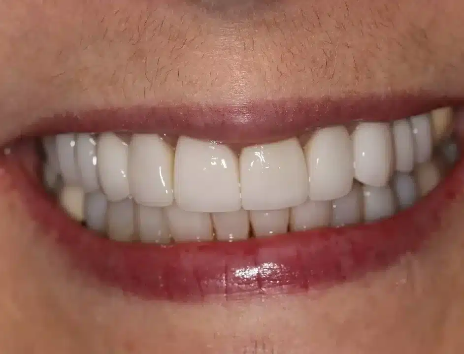 Peggy after aligned v2